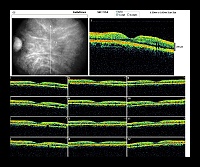 RADIAL LINES OG.jpg